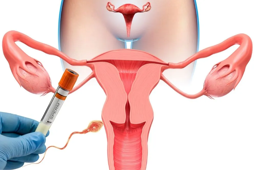 Kısırlık İnfertilite Tedavisi