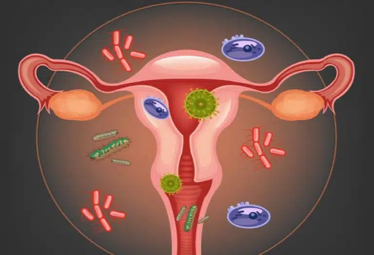 Genital Enfeksiyonlar